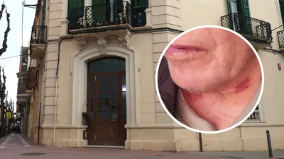 Morats, dutxes amb aigua freda i presumpta sobredosi: La denúncia d'una família contra una residència d'Olesa