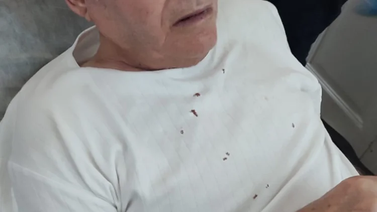 Samarreta en mal estat